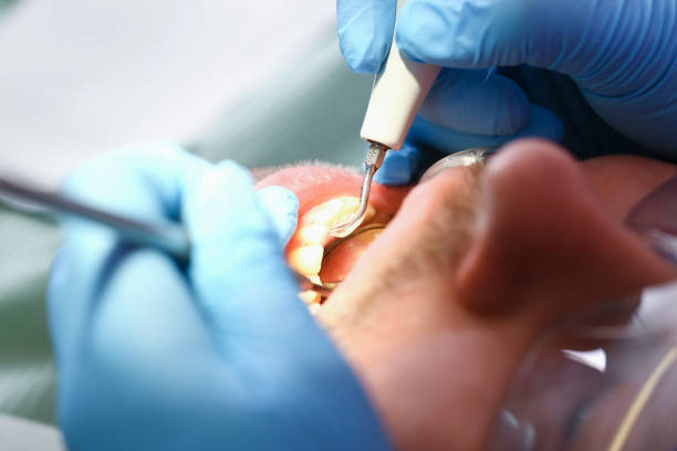Best Emergency Dental Care for Sports Injuries in Kannapolis, NC